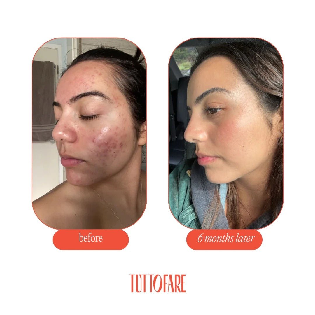 Roman Blue Tallow Balm - 70g - Yo Keto